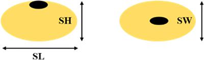Identification of quantitative trait loci (QTLs) and candidate genes for seed shape and 100-seed weight in soybean [Glycine max (L.) Merr.]
